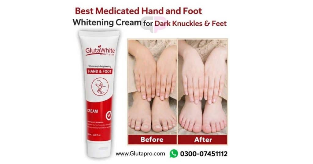 Medicated cream for hand and feet whitening